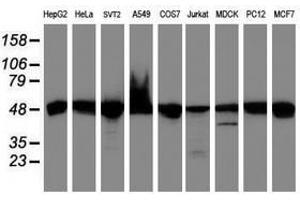 Image no. 2 for anti-Ubiquinol-Cytochrome C Reductase Core Protein I (UQCRC1) (AA 46-305) antibody (ABIN1491532) (UQCRC1 anticorps  (AA 46-305))