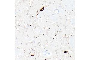 Immunohistochemistry of paraffin-embedded rat brain using Somatostatin (SST) Rabbit mAb (ABIN7270492) at dilution of 1:1000 (40x lens).