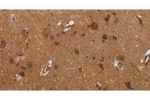 Immunohistochemistry of paraffin-embedded Human brain tissue using FMN2 Polyclonal Antibody at dilution 1:30 (Formin 2 anticorps)
