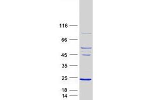 Validation with Western Blot