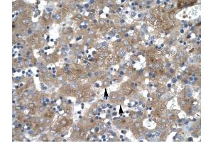 ZNF81 antibody was used for immunohistochemistry at a concentration of 4-8 ug/ml to stain Hepatocyte (arrows) in Human liver. (ZNF81 anticorps  (Middle Region))