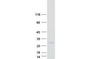 Validation with Western Blot