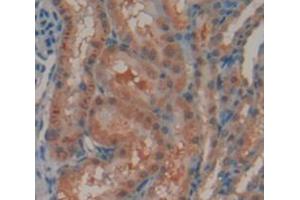 IHC-P analysis of Rat Tissue, with DAB staining. (Androgen Receptor anticorps  (AA 491-679))