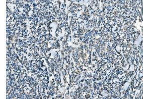 IHC analysis of CCR2 using anti-CCR2 antibody (ABIN7602136).