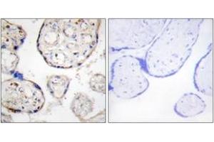 Immunohistochemistry analysis of paraffin-embedded human placenta tissue, using STEAP4 Antibody. (STEAP4 anticorps  (AA 201-250))