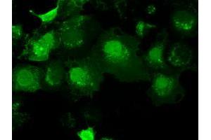 Image no. 4 for anti-Adenylate Kinase 1 (AK1) antibody (ABIN1496515)