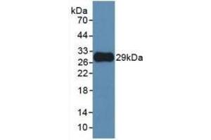 Detection of Recombinant MMP25, Human using Monoclonal Antibody to Matrix Metalloproteinase 25 (MMP25) (MMP25 anticorps  (AA 108-313))