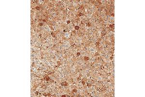 Immunohistochemical analysis of paraffin-embedded Human liver tissue using (ABIN390450 and ABIN2840824) performed on the Leica® BOND RXm. (Albumin anticorps  (C-Term))
