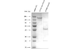 Expression of recombinant CR3022 antibody (SARS-CoV-2 anticorps)