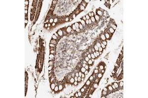 Immunohistochemical staining of human small intestine with ARHGEF10L polyclonal antibody  strong cytoplasmic positivity in glandular cells. (ARHGEF10L anticorps)