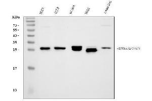 Western blot analysis of GSTA1/A2/A3/A4/A5 using anti-GSTA1/A2/A3/A4/A5 antibody (ABIN3043839).