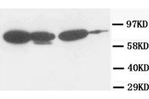 Western Blotting (WB) image for anti-Junction Plakoglobin (JUP) antibody (ABIN1107897) (JUP anticorps)