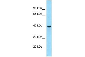 WB Suggested Anti-Qtrtd1 Antibody Titration: 1. (QTRTD1 anticorps  (C-Term))