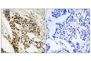 Immunohistochemistry (IHC) image for anti-Mitogen-Activated Protein Kinase-Activated Protein Kinase 2 (MAPKAPK2) (Ser272) antibody (ABIN1848344)