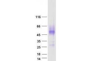 Validation with Western Blot