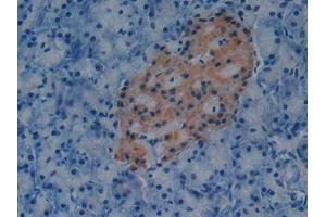 DAB staining on IHC-P; Samples: Mouse Pancreas Tissue (PAI1 anticorps  (AA 141-389))
