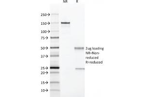 SDS-PAGE Analysis Purified CD28 Mouse Monoclonal Antibody (204. (CD28 anticorps)