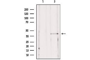 Western blot analysis of extracts from mouse brain, using SSTR2  Antibody. (SSTR2 anticorps  (C-Term))