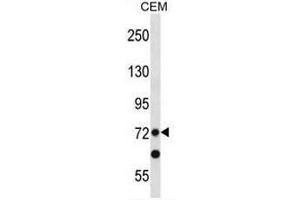 PRDM8 Antibody (N-term) western blot analysis in CEM cell line lysates (35µg/lane). (PRDM8 anticorps  (N-Term))