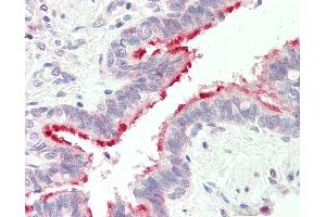 Human, Lung: Formalin-Fixed Paraffin-Embedded (FFPE).