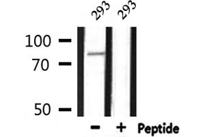 Western blot analysis of extracts from 293, using CDH3 Antibody.