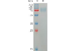 Human PL Protein, His Tag on SDS-PAGE under reducing condition.