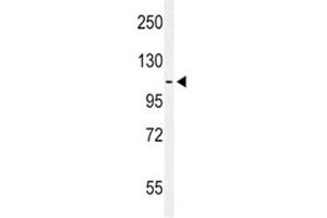 Western blot analysis of EphA2 antibody and MCF-7 lysate.