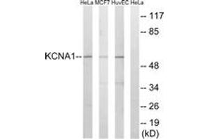 Western blot analysis of extracts from HuvEc/MCF-7/HeLa cells, using KCNA1 Antibody. (KCNA1 anticorps  (AA 256-305))