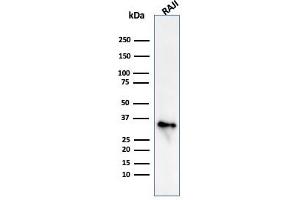 Western Blot Analysis of Raji cell lysate using CD74 Mouse Monoclonal Antibody (CLIP/813) (CD74 anticorps)