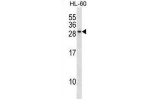 Western Blotting (WB) image for anti-RAB15, Member RAS Onocogene Family (RAB15) antibody (ABIN2998980)