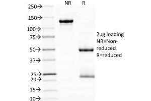 SDS-PAGE Analysis Purified PD1 (CD279) Monoclonal Antibody (NAT105).