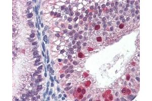 IHC testing of FFPE human uterus tissue with FANCG antibody at 3ug/ml. (FANCG anticorps)