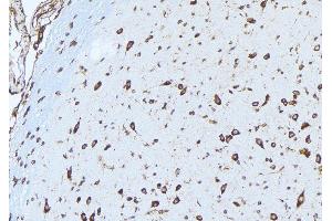 ABIN6277528 at 1/100 staining Mouse brain tissue by IHC-P. (Ephrin A1 anticorps  (Internal Region))