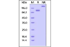 Biotinylated Human CD4, Fc,Avitag on  under reducing (R) and ing (NR) conditions. (CD4 Protein (CD4) (AA 26-396) (Fc Tag,AVI tag,Biotin))
