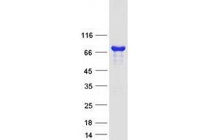 Validation with Western Blot