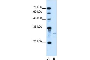 WB Suggested Anti-SHH Antibody Titration:  0. (Sonic Hedgehog anticorps  (N-Term))