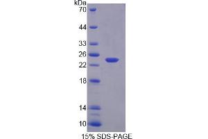 Image no. 1 for Growth Arrest and DNA-Damage-Inducible, gamma (GADD45G) (AA 1-159) protein (His tag) (ABIN4990930)