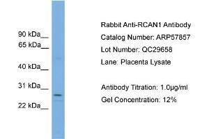 WB Suggested Anti-RCAN1  Antibody Titration: 0. (RCAN1 anticorps  (N-Term))