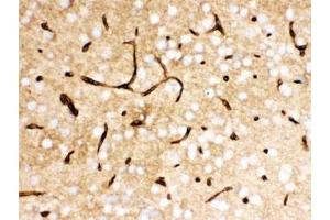 IHC testing of FFPE mouse brain with SLC2A1 antibody.