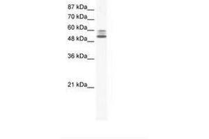 Image no. 1 for anti-Lysine (K)-Specific Demethylase 4D (KDM4D) (AA 434-483) antibody (ABIN202713) (JMJD2D anticorps  (AA 434-483))
