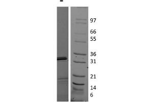 SDS-PAGE of Human Interleukin-17E (IL-25) Recombinant Protein SDS-PAGE of Human Interleukin-17E (IL-25) Recombinant Protein. (IL-25 Protéine)
