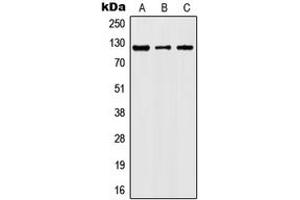Western blot analysis of JAK2 (pY1007) expression in HeLa (A), TF1 (B), NIH3T3 (C), rat kidney (D) whole cell lysates. (JAK2 anticorps  (C-Term, pTyr1007))