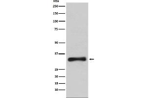 Western blot analysis of Emerin expression in 293T cell lysate.