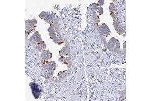 Immunohistochemical staining of human fallopian tube with DNAH6 polyclonal antibody  shows strong membranous positivity in glandular cells. (DNAH6 anticorps)
