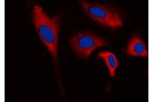 Immunofluorescent analysis of INPP5J staining in HEK293T cells. (INPP5J anticorps  (C-Term))