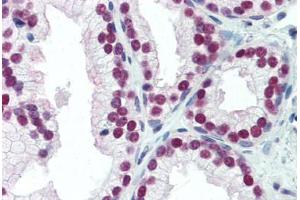 Human Prostate (formalin-fixed, paraffin-embedded) stained with NKX3-1 antibody ABIN462123 followed by biotinylated anti-mouse IgG secondary antibody ABIN481714, alkaline phosphatase-streptavidin and chromogen.