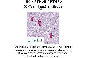 Image no. 1 for anti-Parathyroid Hormone 2 Receptor (PTH2R) (C-Term), (pThr2) antibody (ABIN1738583) (PTH2R anticorps  (C-Term, pThr2))