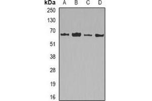 Western blot analysis of Lamin B2 expression in HepG2 (A), MCF7 (B), mouse liver (C), mouse heart (D) whole cell lysates. (Lamin B2 anticorps)