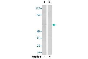 Western blot analysis of extracts from HeLa cells, using ADRB2 polyclonal antibody . (beta 2 Adrenergic Receptor anticorps  (C-Term))