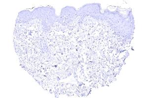 Absence of KRT13 staining in the keratinizing squamous epithelium of the skin